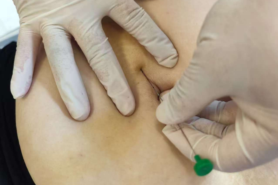 111e0ff37f0fcefa44f624b94d406448.png 5.png